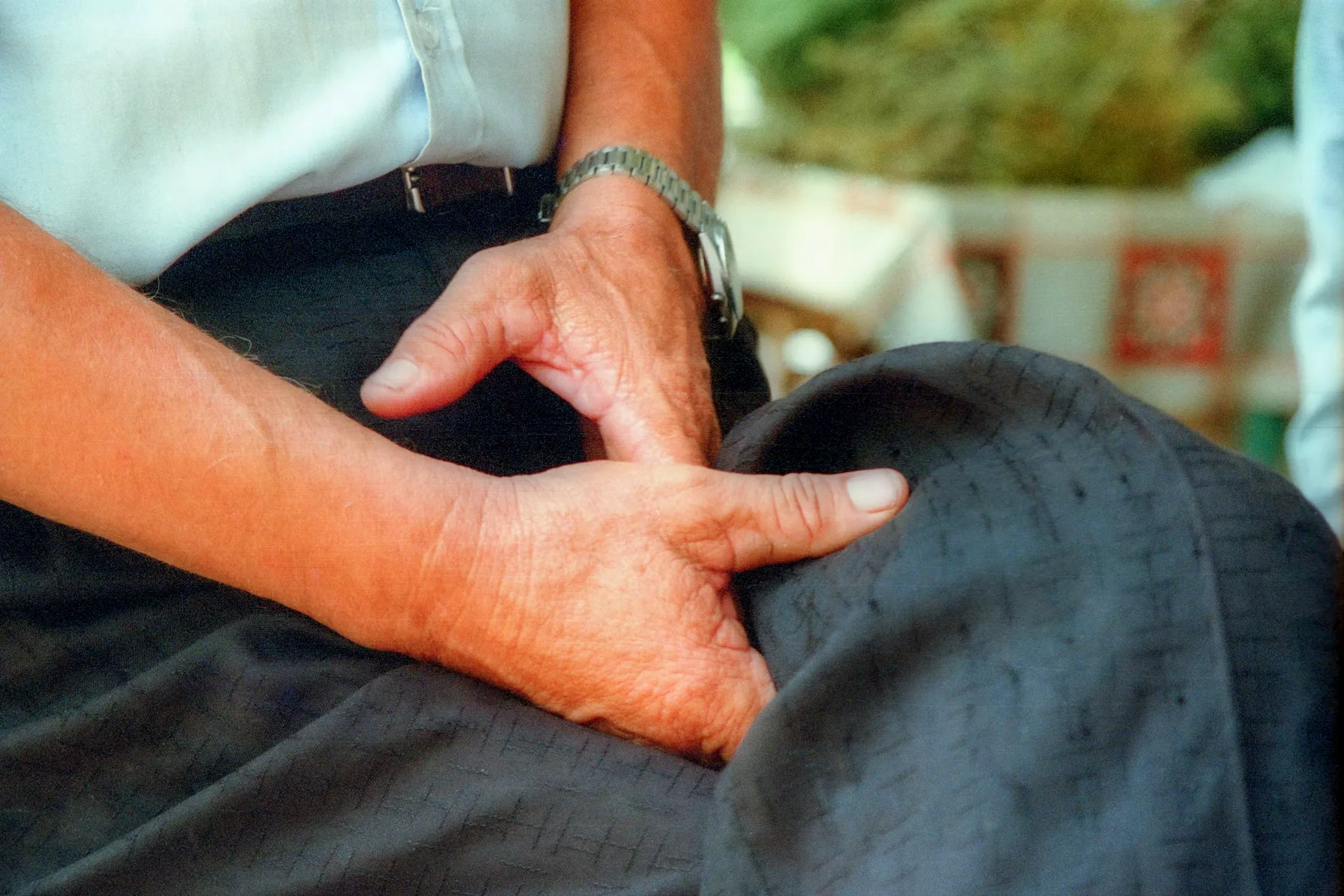 Enlarged Prostate (BPH): Warning Signs and Modern Treatment Options